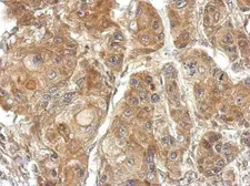 Anti-TSR2 antibody used in IHC (Paraffin sections) (IHC-P). GTX121118