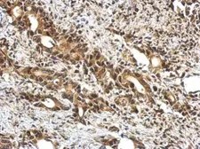 Anti-Ubiquilin 4 antibody [N2C2], Internal used in IHC (Paraffin sections) (IHC-P). GTX121126