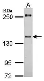 Anti-URB2 antibody [C2C3], C-term used in Western Blot (WB). GTX121132