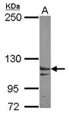 Anti-XPO6 antibody [N1N3] used in Western Blot (WB). GTX121149
