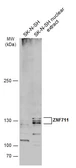 Anti-ZNF711 antibody used in Western Blot (WB). GTX121177