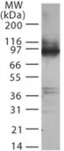 Anti-TLR2 antibody used in Western Blot (WB). GTX12118