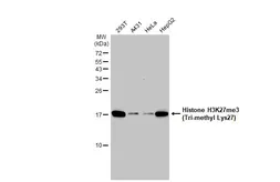 Anti-Histone H3K27me3 (Tri-methyl Lys27) antibody used in Western Blot (WB). GTX121184
