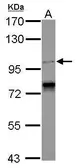 Anti-CCDC52 antibody [C2C3], C-term used in Western Blot (WB). GTX121201
