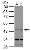 Anti-CHRFAM7A antibody [N1N3] used in Western Blot (WB). GTX121209