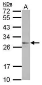 Anti-eIF4H antibody used in Western Blot (WB). GTX121223
