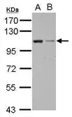 Anti-EXOC2 antibody used in Western Blot (WB). GTX121228