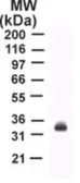 Anti-TRAIL antibody [55B709.3] used in Western Blot (WB). GTX12124