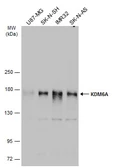 Anti-KDM6A antibody [N2C1], Internal used in Western Blot (WB). GTX121246