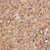 Anti-sRANKL antibody [12A380] used in IHC (Paraffin sections) (IHC-P). GTX12125