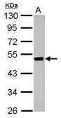 Anti-Keratin 36 antibody used in Western Blot (WB). GTX121250