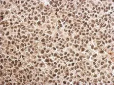 Anti-MAGEB18 antibody used in IHC (Paraffin sections) (IHC-P). GTX121257