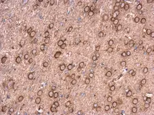 Anti-NCALD antibody used in IHC (Paraffin sections) (IHC-P). GTX121264