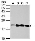 Anti-NCALD antibody used in Western Blot (WB). GTX121264