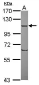 Anti-ORP8 antibody used in Western Blot (WB). GTX121273
