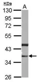 Anti-PHYHIP antibody used in Western Blot (WB). GTX121276