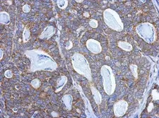 Anti-PITRM1 antibody used in IHC (Paraffin sections) (IHC-P). GTX121279