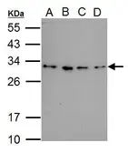 Anti-RWDD3 antibody used in Western Blot (WB). GTX121303