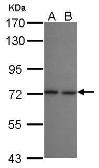 Anti-LZTR2 antibody [N1N2], N-term used in Western Blot (WB). GTX121305