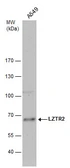 Anti-LZTR2 antibody [N1N2], N-term used in Western Blot (WB). GTX121305