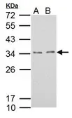 Anti-TPRG1L antibody used in Western Blot (WB). GTX121336
