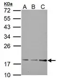 Anti-TRAPPC3 antibody used in Western Blot (WB). GTX121338