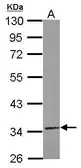 Anti-TRUB2 antibody [N1C3] used in Western Blot (WB). GTX121339