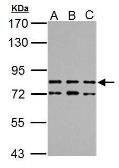 Anti-TTC14 antibody used in Western Blot (WB). GTX121340