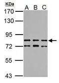 Anti-TTC14 antibody used in Western Blot (WB). GTX121340