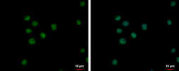 Anti-ZNF33A antibody used in Immunocytochemistry/ Immunofluorescence (ICC/IF). GTX121369