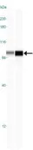 Anti-IKK alpha antibody [14A231] used in Western Blot (WB). GTX12138