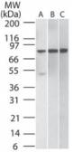 Anti-IKK beta antibody [10AG2] used in Western Blot (WB). GTX12139