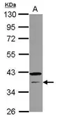 Anti-CNTD1 antibody [N2C3] used in Western Blot (WB). GTX121398