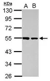 Anti-DUS2L antibody used in Western Blot (WB). GTX121407