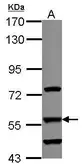 Anti-DUS2L antibody used in Western Blot (WB). GTX121408