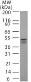 Anti-IKK gamma antibody [46B844] used in Western Blot (WB). GTX12141