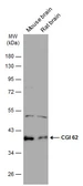 Anti-CGI 62 antibody used in Western Blot (WB). GTX121412