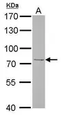 Anti-FBXO21 antibody used in Western Blot (WB). GTX121415