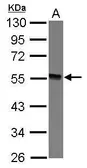 Anti-GTDC1 antibody used in Western Blot (WB). GTX121445