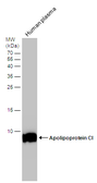 Anti-Apolipoprotein CI antibody used in Western Blot (WB). GTX121456