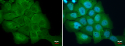 Anti-S100 alpha 2 antibody [N1C3] used in Immunocytochemistry/ Immunofluorescence (ICC/IF). GTX121457