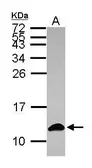 Anti-S100A6 antibody used in Western Blot (WB). GTX121460