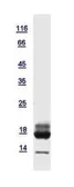 Human RBP5 protein, His tag. GTX121469-pro