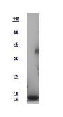 Human Galectin 7 protein, His tag. GTX121475-pro