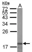 Anti-Galectin 7 antibody used in Western Blot (WB). GTX121475