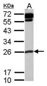 Anti-COMMD10 antibody used in Western Blot (WB). GTX121488