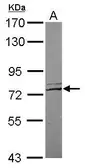 Anti-Netrin G1 ligand antibody [N1N3] used in Western Blot (WB). GTX121508