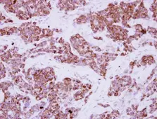 Anti-LRRC23 antibody used in IHC (Paraffin sections) (IHC-P). GTX121536