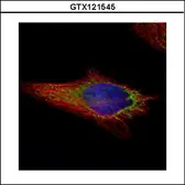 Anti-NAPRT1 antibody used in Immunocytochemistry/ Immunofluorescence (ICC/IF). GTX121545