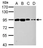 Anti-OSBPL9 antibody used in Western Blot (WB). GTX121551